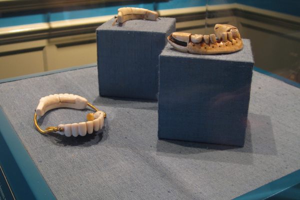 Washington’s Dentures