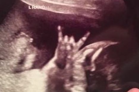 This Unborn Baby's Ultrasound Is Extremely Metal