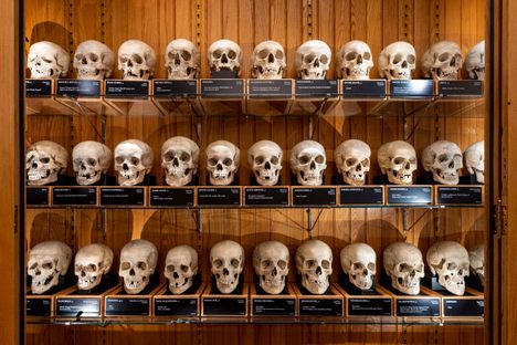 The Hyrtl Skull Collection isn't just medical history. Scientists continue to study the bones today.