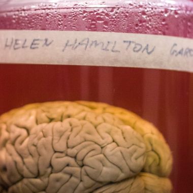 Brain of Helen Hamilton Gardener