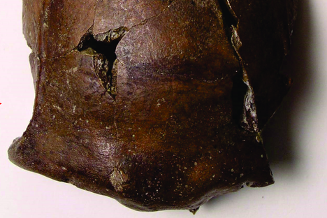 The cranium of the unknown victim.
